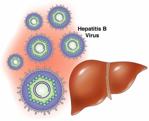 hepatitisB