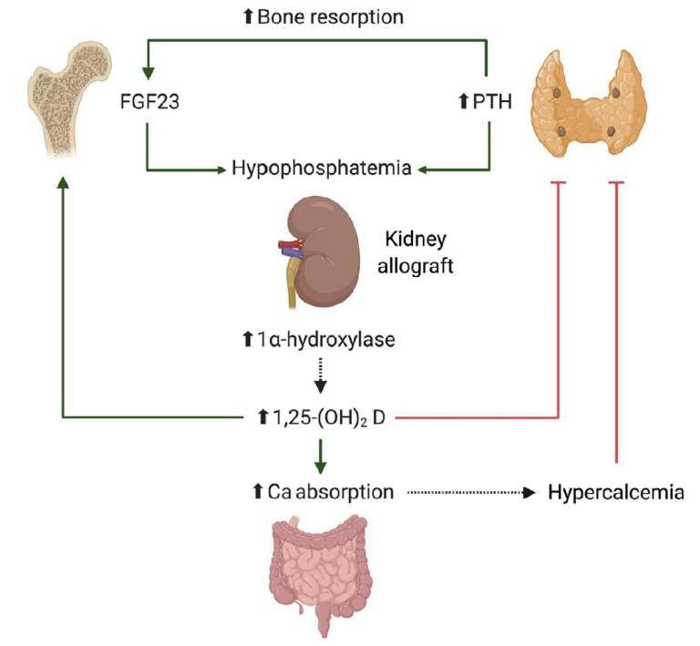 Mineral Bone Disorders In Kidney Transplantation – Dr. Leonardo Riella